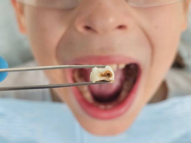 Best Pediatric Emergency Dentist in Pleasant Prairie, WI